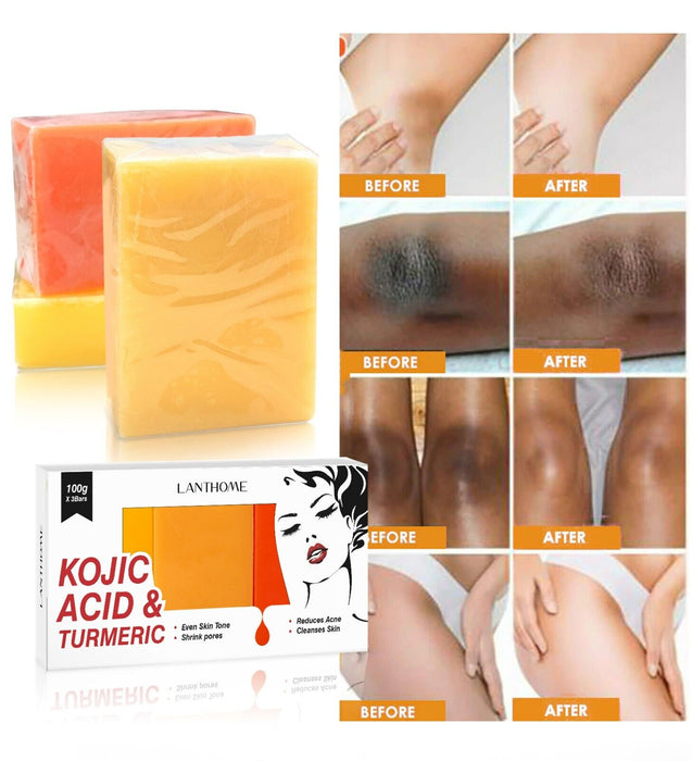 KojicAcidSeriesSet2