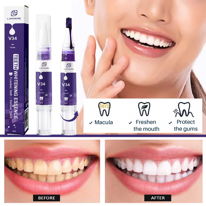V34 Teeth Whitening Essence: Brighten Your Smile Naturally
